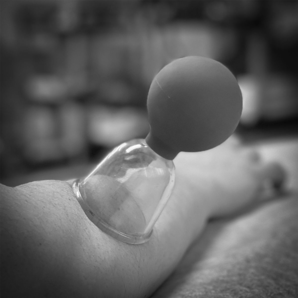 Cupping_bw-1200x1200.jpg